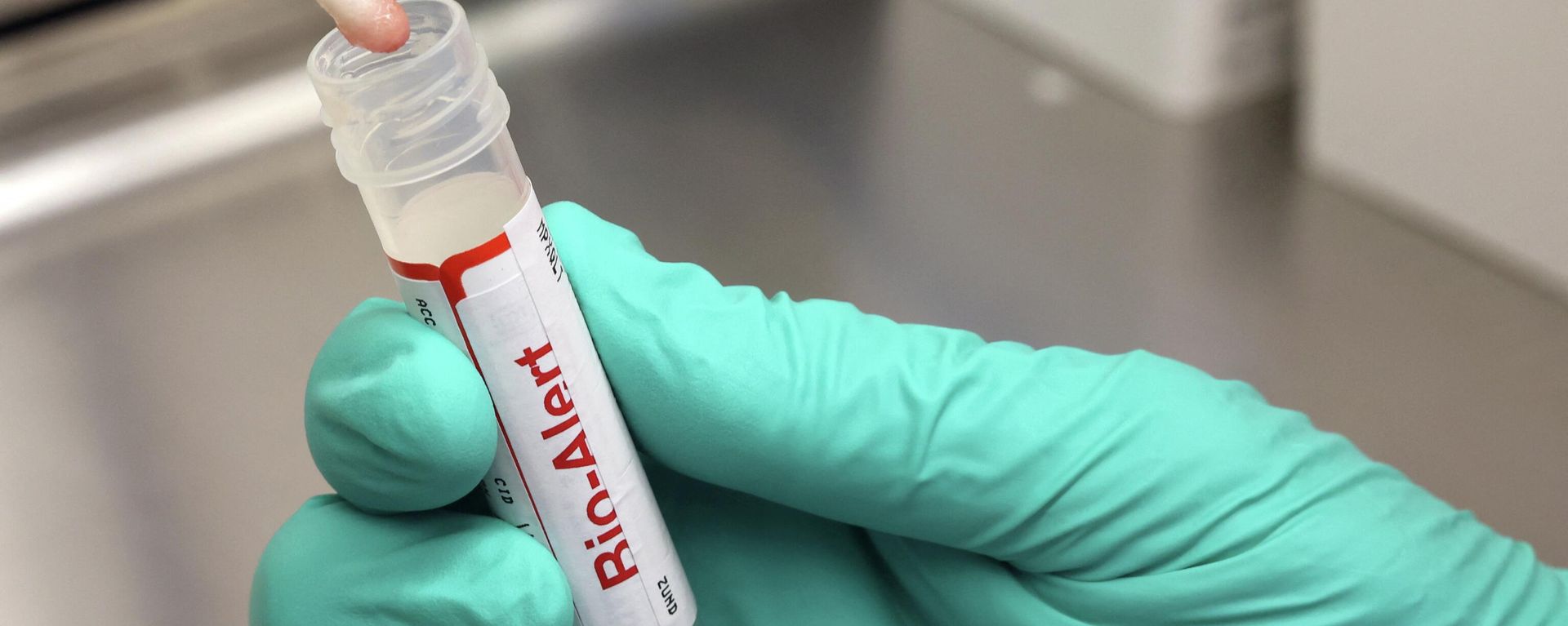 SEATTLE, WA - JULY 12: A swab that tested positive for the Monkeypox virus is seen at the UW Medicine Virology Laboratory at the UW Medicine Virology Laboratory on July 12, 2022 in Seattle, Washington.  - Sputnik International, 1920, 30.07.2022