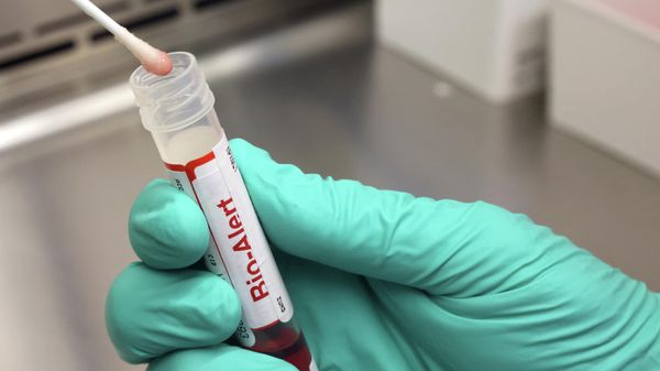 SEATTLE, WA - JULY 12: A swab that tested positive for the Monkeypox virus is seen at the UW Medicine Virology Laboratory at the UW Medicine Virology Laboratory on July 12, 2022 in Seattle, Washington.  - Sputnik International