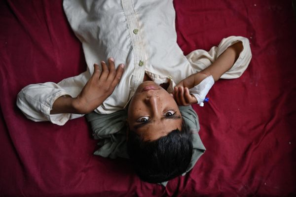 This photo taken on 22 July 2022 shows a cholera patient resting in a ward at Musa Qala District Hospital in Musa Qala, Helmand. - Sputnik International