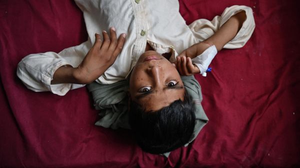 This photo taken on July 22, 2022 shows a cholera patient resting in a ward at the Musa Qala District Hospital in Musa Qala, Helmand.  - Sputnik International