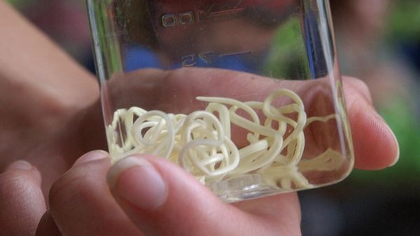 A jar containing Guinea worms - Sputnik International