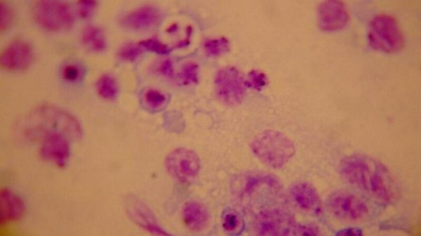 Leishmaniasis - Sputnik International