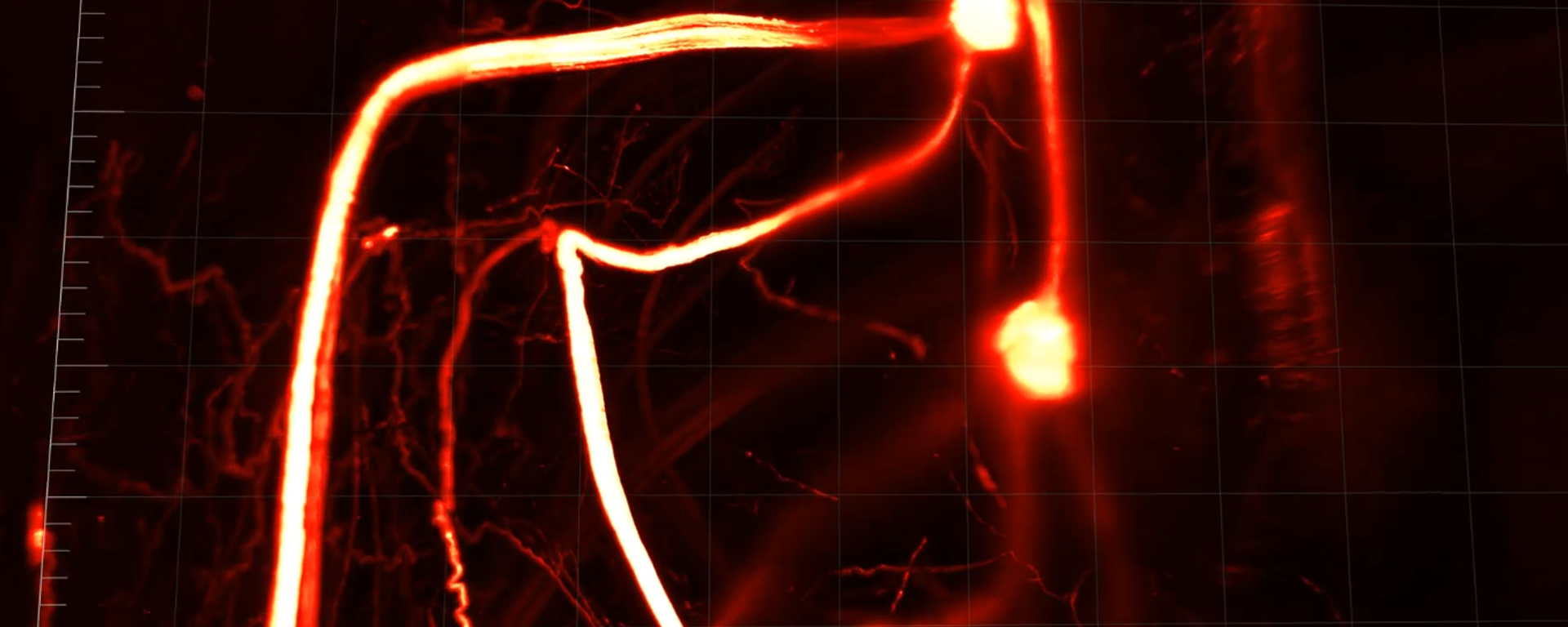 Scientists discover sensory neurons that carry messages between fat tissue and the brain - Sputnik International, 1920, 01.09.2022