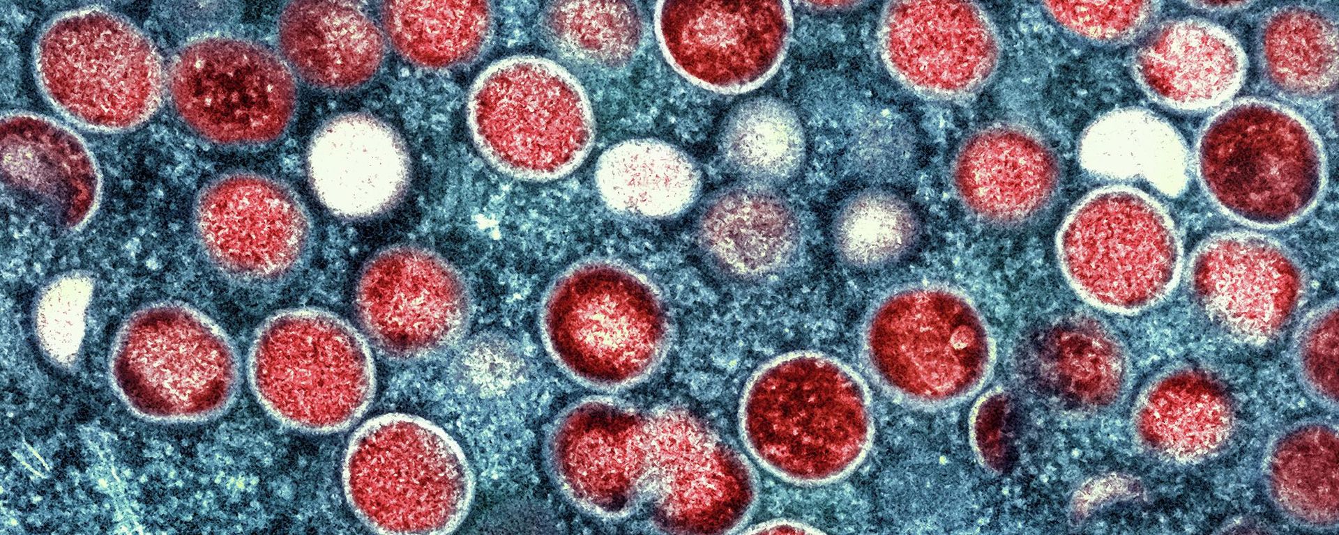 Colorized transmission electron micrograph of monkeypox particles (File) Colorized transmission electron micrograph of monkeypox particles (File) - Sputnik International, 1920, 16.08.2024