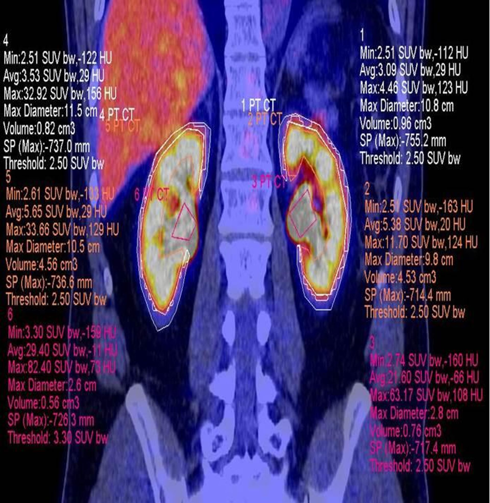 Normal renal energy metabolism, no nephrological anamnesis Normal renal energy metabolism, no nephrological anamnesis - Sputnik International, 1920, 10.10.2022