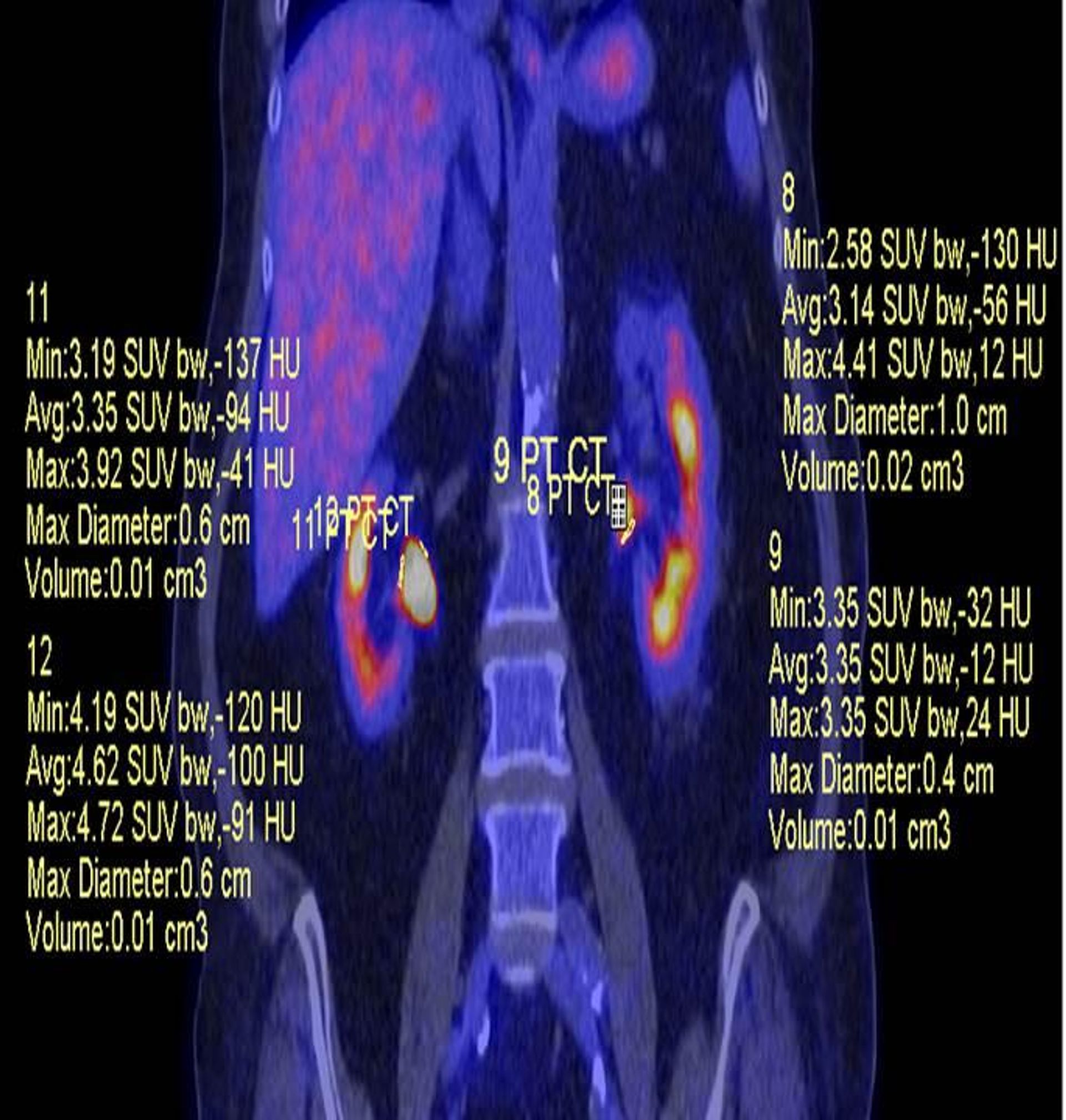 Hypoactive metabolism with first-time urinary syndrome detected Hypoactive metabolism with first-time urinary syndrome detected - Sputnik International, 1920, 10.10.2022