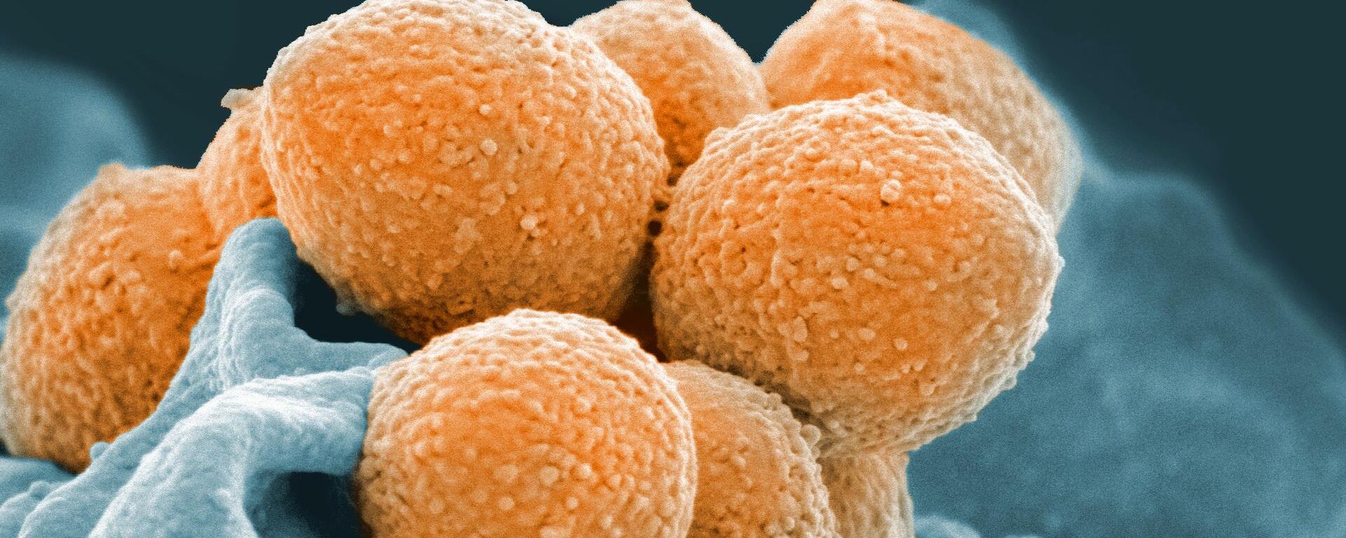 An electron microscope image of Group A Streptococcus An electron microscope image of Group A Streptococcus - Sputnik International, 1920, 18.12.2022
