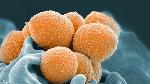 An electron microscope image of Group A Streptococcus - Sputnik International