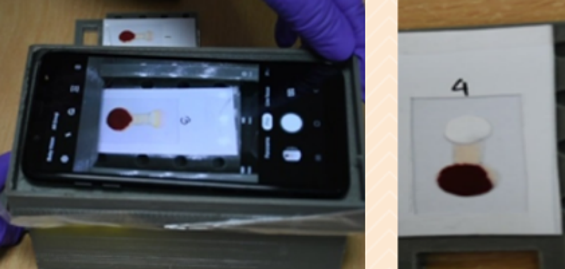 Prototype of diagnostics with finger-prick blood on paper strip  - Sputnik International, 1920, 06.12.2022