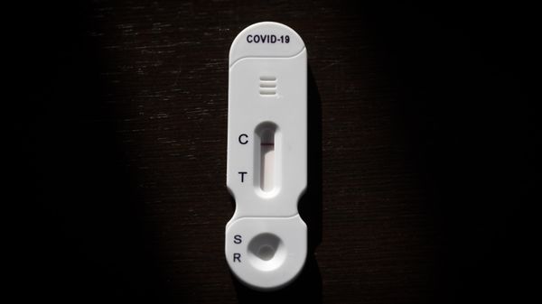 A COVID-19 test is pictured at NG Biotech - Sputnik International