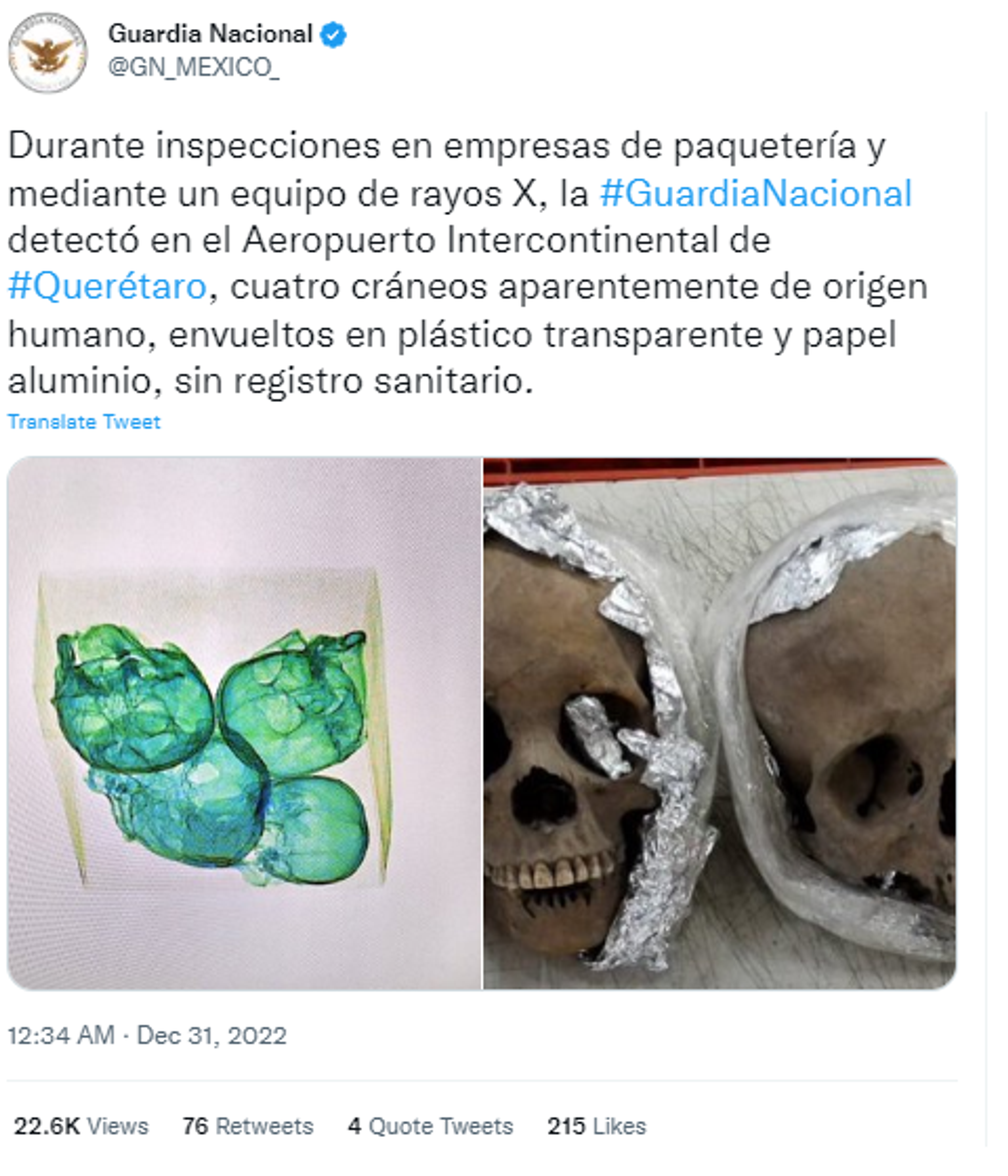 Skulls in Airport - Sputnik International, 1920, 31.12.2022