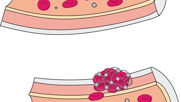 Blood Clot Anatomy - Sputnik International