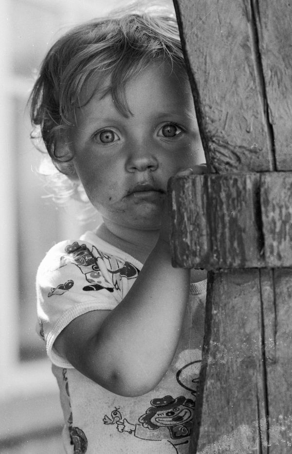 A child from the village of Chudyany, affected by radiation as a result of the Chernobyl accident. - Sputnik International