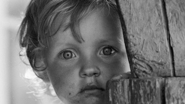 A child from the village of Chudyany, affected by radiation as a result of the Chernobyl accident. - Sputnik International