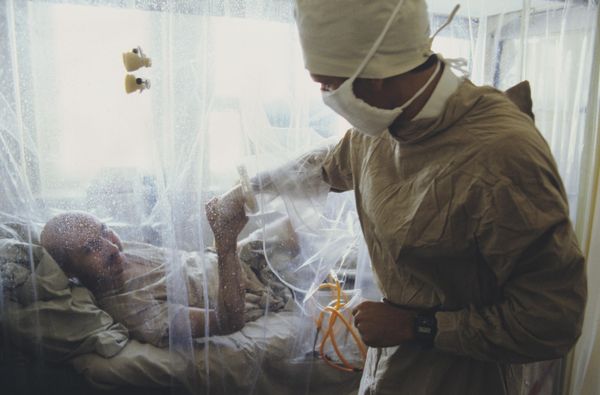 Chernobyl accident victim being treated at the 6th City Clinical Hospital of the USSR's Ministry of Health. - Sputnik International
