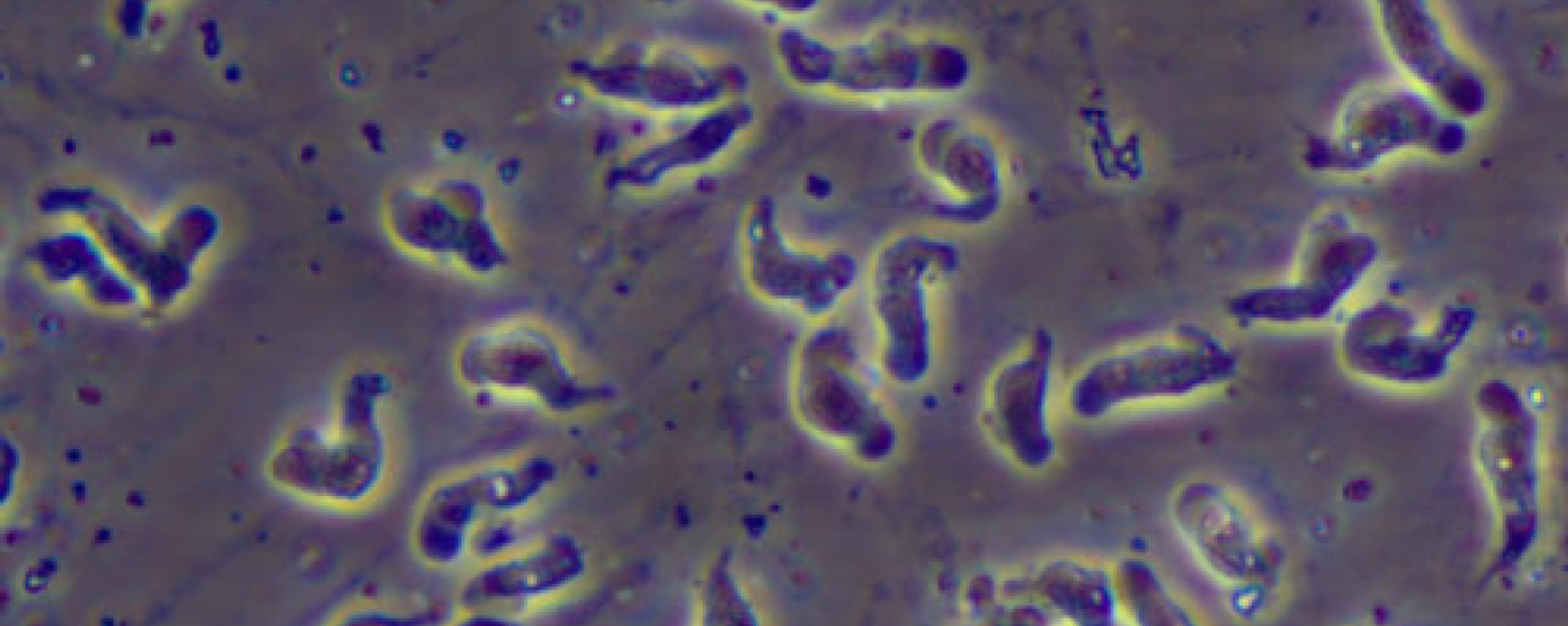 A wet mount of Naegleria fowleri trophozoites (brain-eating amoebas) cultured from the cerebrospinal fluid of a patient with primary amoebic meningocephalitis viewed using phase contrast microscopy. 600x magnification. - Sputnik International, 1920, 31.07.2023
