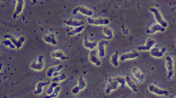 A wet mount of Naegleria fowleri trophozoites (brain-eating amoebas) cultured from the cerebrospinal fluid of a patient with primary amoebic meningocephalitis viewed using phase contrast microscopy. 600x magnification. - Sputnik International