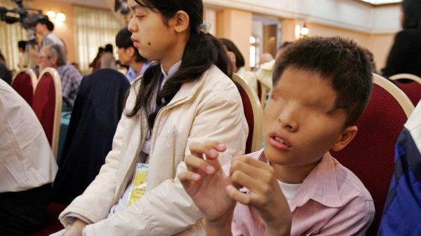 Vietnam's 14 years old Agent Orange victim Le Van O, from the southern province of Kien Giang attends an international conference on the effects of the Vietnam War defoliant Agent Orange, in Hanoi, 28 March 2006.  - Sputnik International