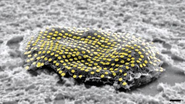 mouse fibroblast dotted with gold nanodots. - Sputnik International