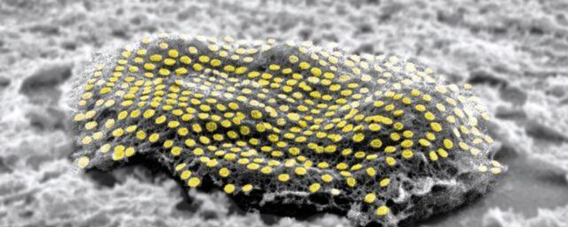 mouse fibroblast dotted with gold nanodots. - Sputnik International, 1920, 27.08.2023