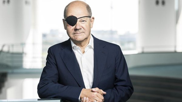 Olaf Scholz wearing an eyepatch after a jogging accident. - Sputnik International