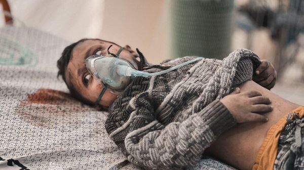 An injured boy from Gaza Strip - Sputnik International