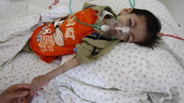 Palestinian boy Haitham Matar, who suffers from malnutrition, lies on a hospital bed in Gaza City on May 28, 2009. Israel's recent war on Gaza brought the enclave to the brink of a catastrophe, Amnesty International said on May 28, also lambasting the two main Palestinian factions for human rights violations. AFP PHOTO/MOHAMMED ABED (Photo by MOHAMMED ABED / AFP) - Sputnik International
