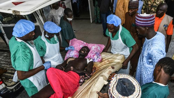 An injured man grimaces in pain as he arrives for treatment after a wave of suicide attacks in the North East of Nigeria (Photo by Audu MARTE / AFP) - Sputnik International