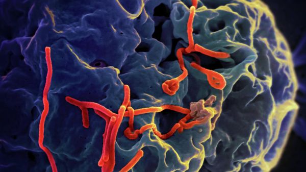 Ebola virus under the microscope - Sputnik International