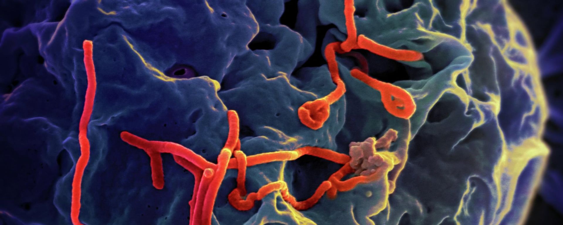 Ebola virus under the microscope Ebola virus under the microscope - Sputnik International, 1920, 20.09.2022