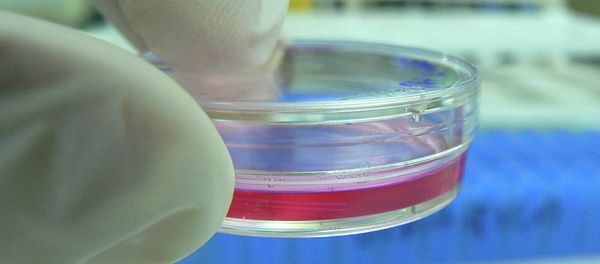 Bacteria on plate that is antibiotic resistant. Bacteria on plate that is antibiotic resistant. - Sputnik International