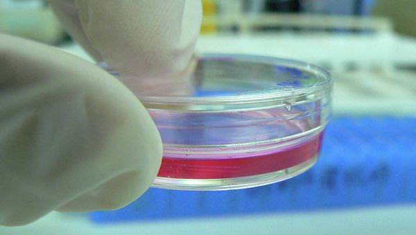Bacteria on plate that is antibiotic resistant. Bacteria on plate that is antibiotic resistant. - Sputnik International