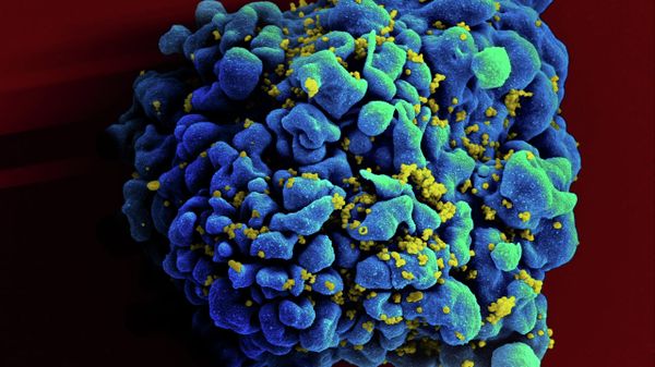 HIV-infected H9 T cell - Sputnik International