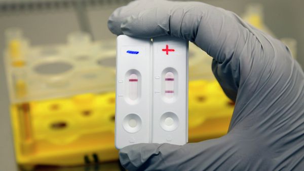 A researcher of the Atomic Energy Commission (CEA) holds Ebola diagnostic tests in Marcoule, November 3, 2014 - Sputnik International