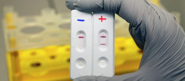 A researcher of the Atomic Energy Commission (CEA) holds Ebola diagnostic tests in Marcoule, November 3, 2014 A researcher of the Atomic Energy Commission (CEA) holds Ebola diagnostic tests in Marcoule, November 3, 2014 - Sputnik International