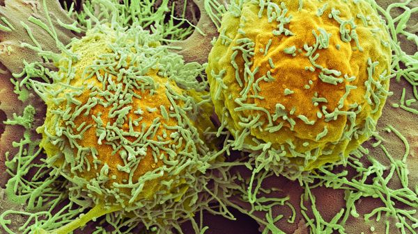 Liver cancer - Sputnik International