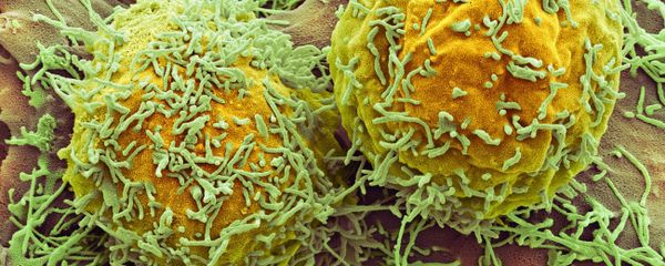 Liver cancer - Sputnik International