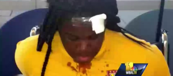 Three middle school girls were injured in an altercation with a school police officer in Northeast Baltimore without any apparent provocation. Three middle school girls were injured in an altercation with a school police officer in Northeast Baltimore without any apparent provocation. - Sputnik International