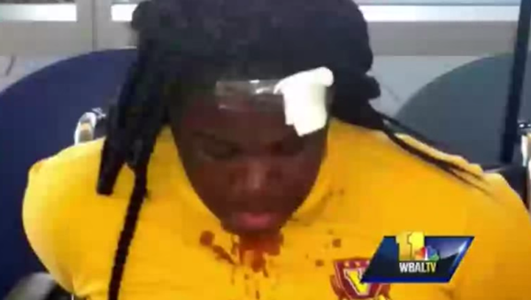 Three middle school girls were injured in an altercation with a school police officer in Northeast Baltimore without any apparent provocation. - Sputnik International