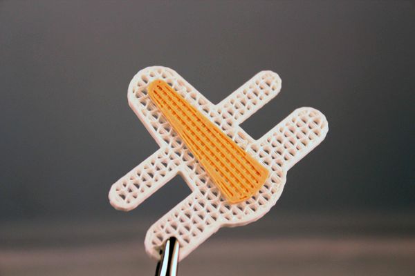 3D printed plastic casts and splints - Sputnik International