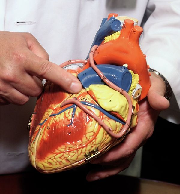 A doctor uses a model of the human heart to point out one of the three major coronary arteries, the one sometimes called the widowmaker. - Sputnik International