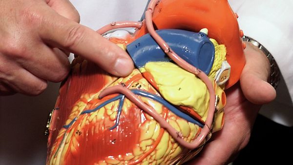 A doctor uses a model of the human heart to point out one of the three major coronary arteries, the one sometimes called the widowmaker. - Sputnik International