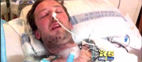 Dustin Theoharis had over twelve reconstructive surgeries after two officers shot him sixteen times over a mistaken identity Dustin Theoharis had over twelve reconstructive surgeries after two officers shot him sixteen times over a mistaken identity - Sputnik International