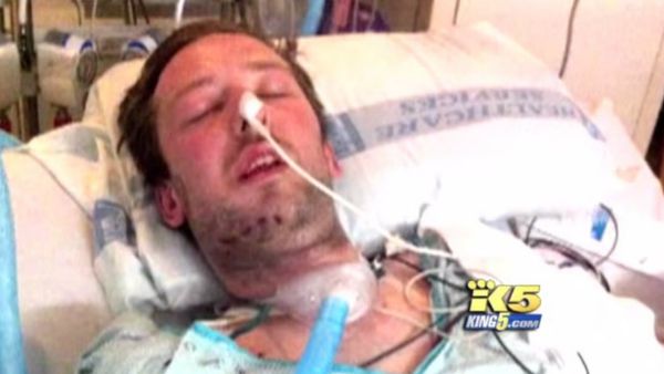 Dustin Theoharis had over twelve reconstructive surgeries after two officers shot him sixteen times over a mistaken identity Dustin Theoharis had over twelve reconstructive surgeries after two officers shot him sixteen times over a mistaken identity - Sputnik International