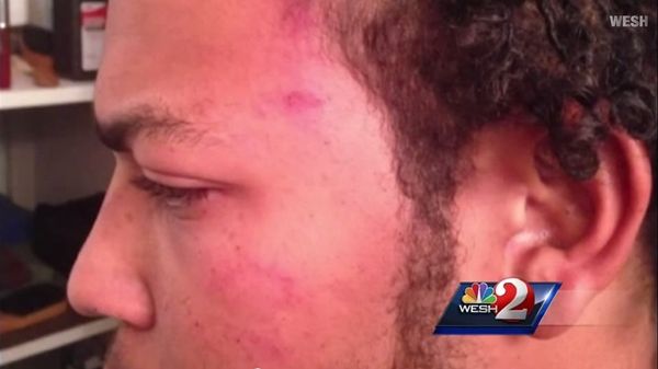 Air Force Vet Violently Beaten and Pepper Sprayed by Cops (VIDEO) Air Force Vet Violently Beaten and Pepper Sprayed by Cops (VIDEO) - Sputnik International