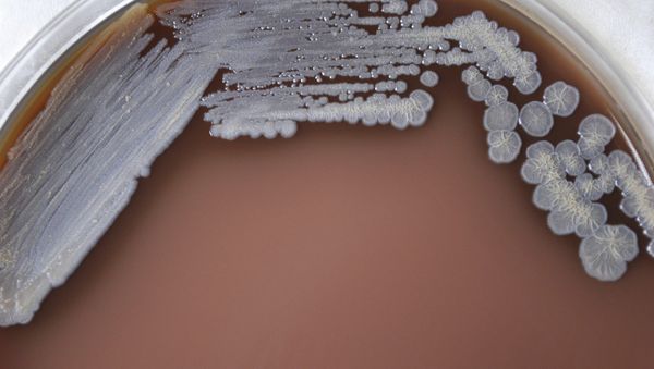 Burkholderia pseudomallei Burkholderia pseudomallei - Sputnik International