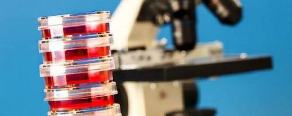 Petri dishes and laboratory microscope Petri dishes and laboratory microscope - Sputnik International