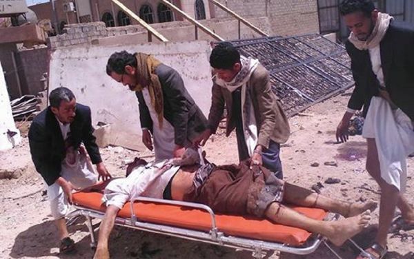 A victim of the attack on a Mosque in Sanaa on March 20, 2015. A Sputnik correspondent took these photos at the scene of the explosion. A victim of the attack on a Mosque in Sanaa on March 20, 2015. A Sputnik correspondent took these photos at the scene of the explosion. - Sputnik International