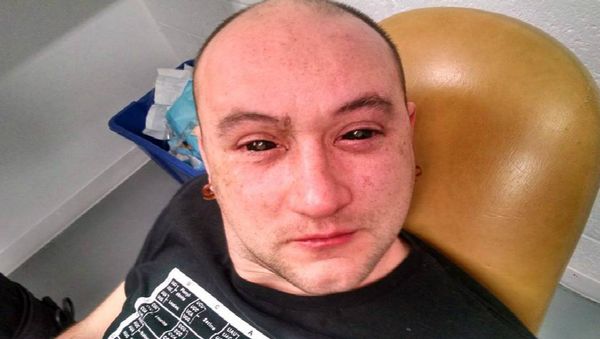 Science for the Masses biochemical researcher Gabriel Licina after having Ce6 dropped into his eyes. - Sputnik International