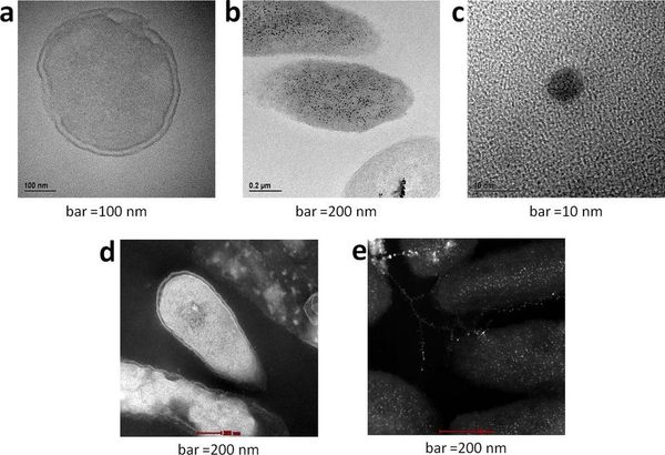 TEM (bright background) and STEM (dark background) of P. aeruginosa before (a and d) and after (b, c and e) treatment with silver; the black (b) and white (e) granules represent silver deposition which account for the zombies biocidal action. TEM (bright background) and STEM (dark background) of P. aeruginosa before (a and d) and after (b, c and e) treatment with silver; the black (b) and white (e) granules represent silver deposition which account for the zombies biocidal action. - Sputnik International